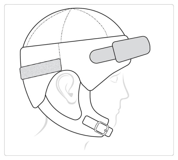 Stirnschutz für Starlight® Secure Leder
